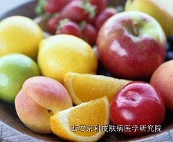 牛皮癣预防吃什么食物